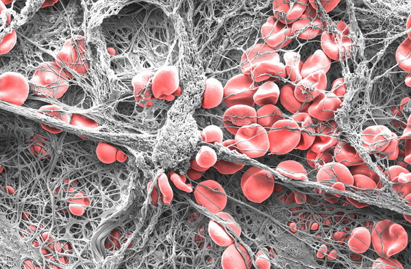 نمای میکروسکوپی لخته خون-تست زمان پروترومبین روش تشخیص لخته شدن