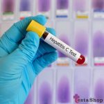 کیت تشخیص هپاتیت hepatitis-HCV-Test