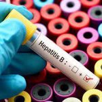 کیت تشخیص هپاتیت بی hepatitis-HbsAg-Test