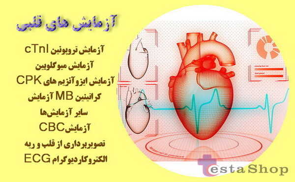 آزمایش تروپونین، کیت تروپونین قلبی، آزمایش cTnI و سایر آزمایش ها و روش های تشخیص قلبی