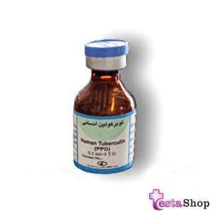 آزمایش ppd | تست توبرکولین | تست سل