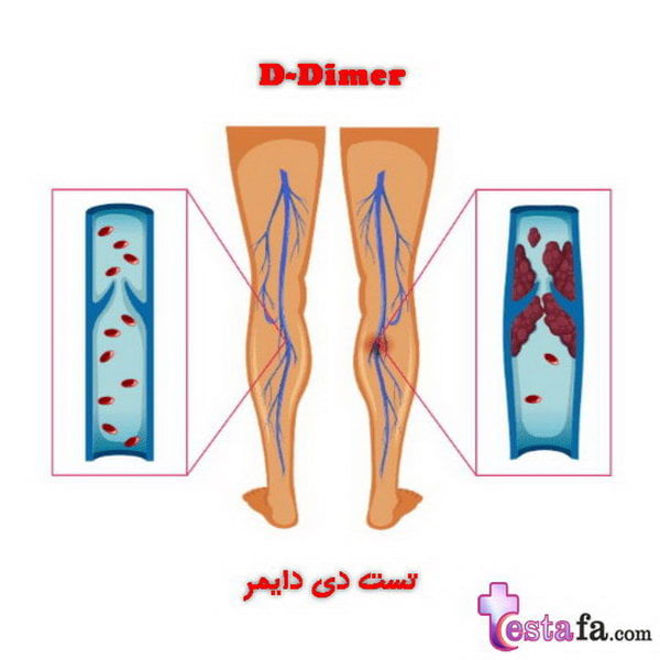 آزمایش D-dimer (دی دایمر)
