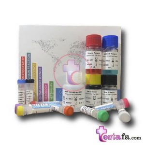 معرفی کیت الیزای DHEA-S مونوسنت ویژه آزمایش دهیدرواپی آندروسترون