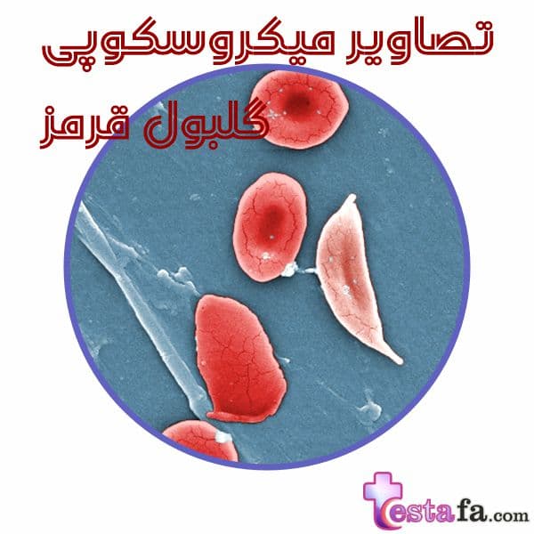 پرونورموبلاست - رتیکولوسیت - RBC - تصاویر میکروسکوپی گلبول قرمز