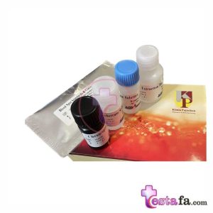 کیت الایزا PKU کیمیا پژوهان - کیت سنجش فنیل آلانین - کیت PKU