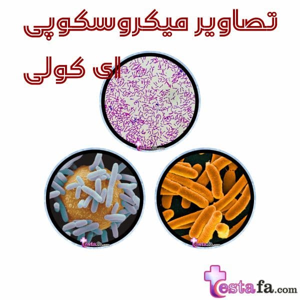 تصاویر میکروسکوپی E. coli - تصویر باکتری ای کولی