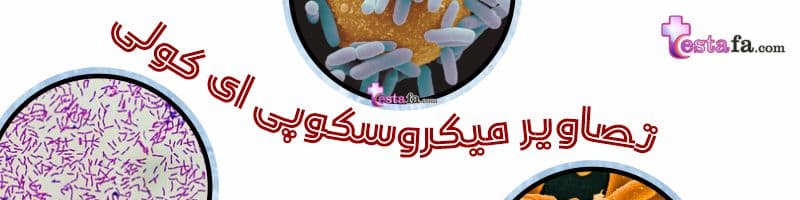 تصویر باکتری ای کولی - تصاویر میکروسکوپی E. coli
