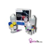 بیماری التهابی روده IBD - کیت کالپروتکتین BIOHIT