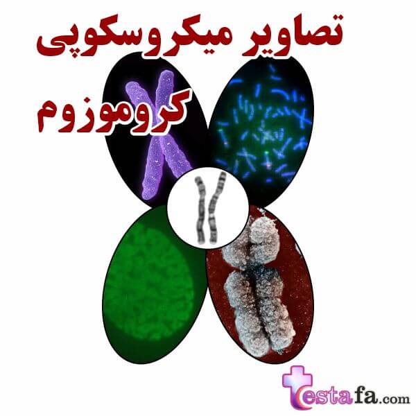 تصاویر میکروسکوپی کروموزوم - میکروگرافی chromosome
