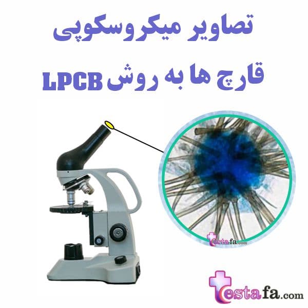 تصاویر میکروسکوپی قارچ ها - قارچ های بیماری زا - روش LPCB