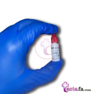 کنترل وزن مخصوص ادرار - رفرکتو تست بهارافشان