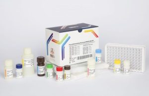 کیت سنجش TSH (192 تستی) الایزا